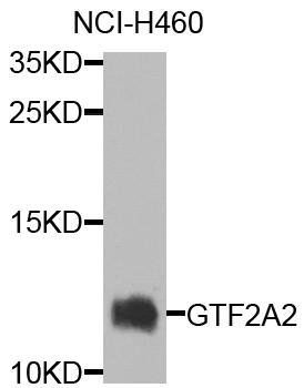GTF2A2 antibody
