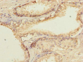 GTF2A2 Antibody