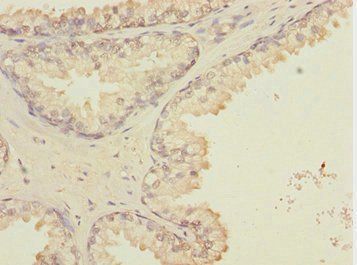 GTF2A2 Antibody