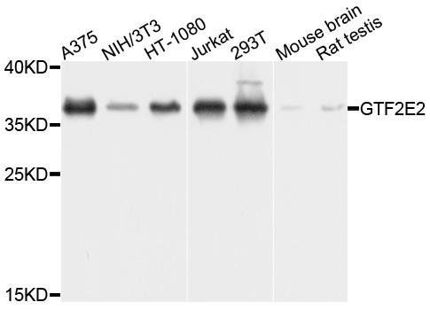 GTF2E2 antibody