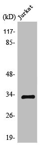 GTF2E2 Antibody