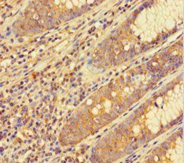 GTF2F1 Antibody