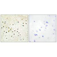 GTF2H1 Antibody