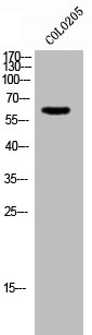 GTF2H2 antibody