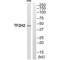 GTF2H2 antibody