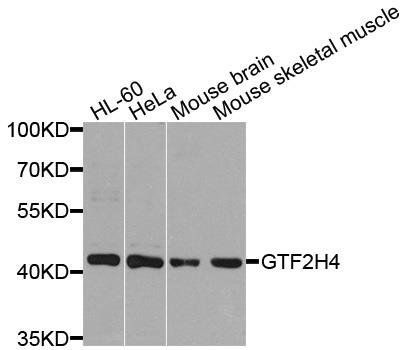 GTF2H4 antibody