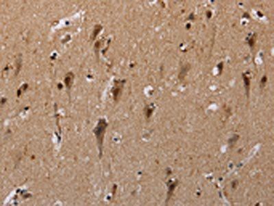 GTF2I Antibody