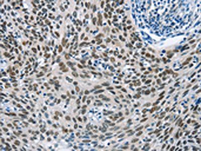 GTF2I Antibody