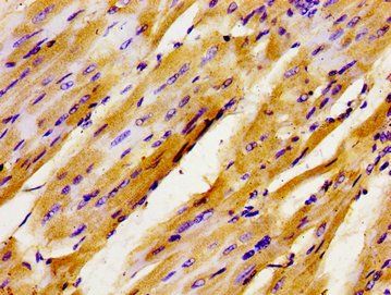 GTF2IRD1 Antibody