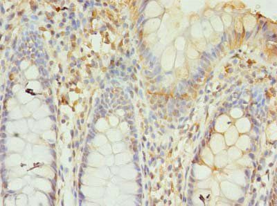 GTF3C6 Antibody