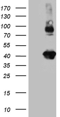 GTP cyclohydrolase 1 (GCH1) antibody