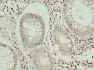 KRAS Antibody