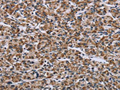 GTPBP10 antibody