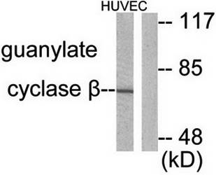 Guanylate Cyclase beta antibody