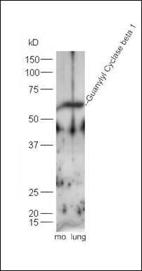 Guanylyl Cyclase beta 1 antibody