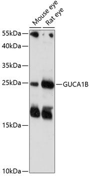 GUCA1B antibody