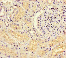 GUCY1A1 Antibody