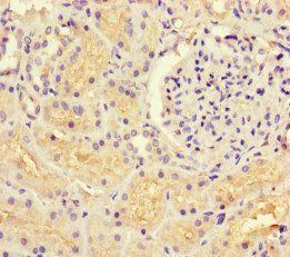 GUCY1A3 antibody