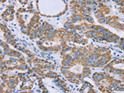 GUCY1A3 Antibody