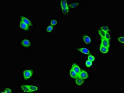 GUCY2C antibody