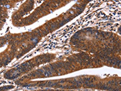GUK1 Antibody