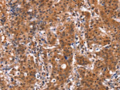 GUK1 Antibody