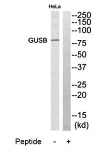 GUSB antibody