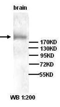 TNRC6A antibody