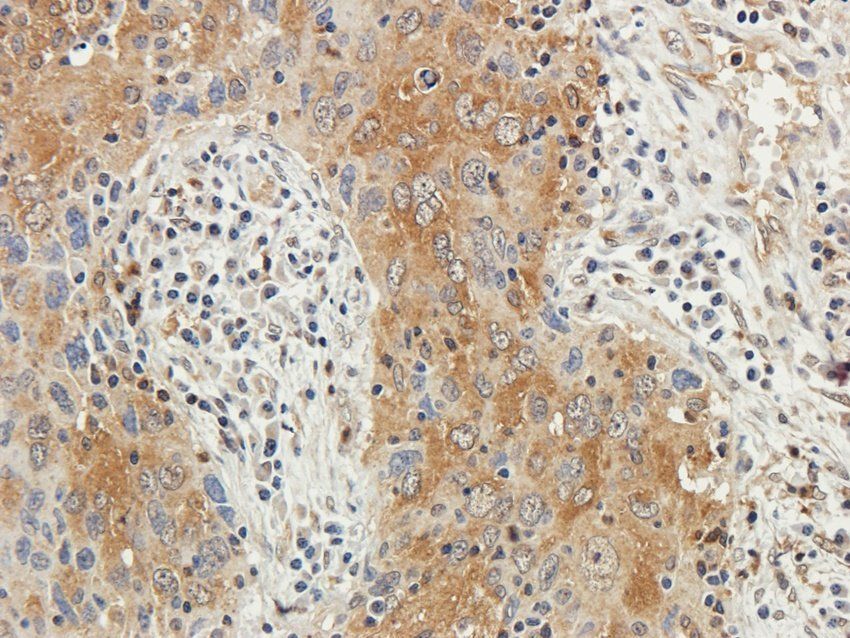 GYG1 antibody