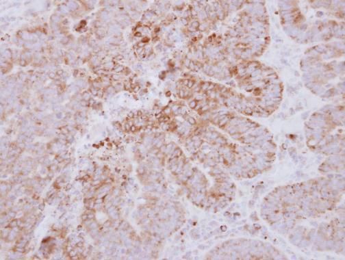 GYG2 antibody