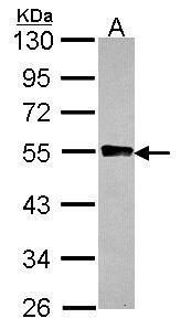 GYG2 Rabbit Polyclonal Antibody