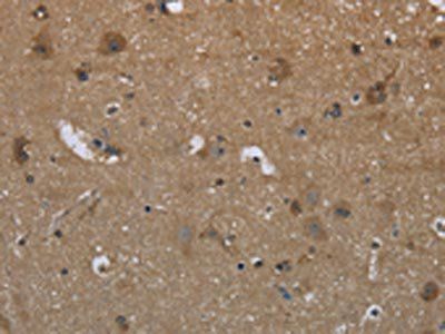 GYS2 Antibody