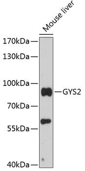 GYS2 antibody