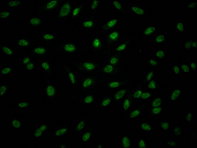 GZMB Recombinant Monoclonal Antibody