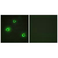 GZMH Antibody