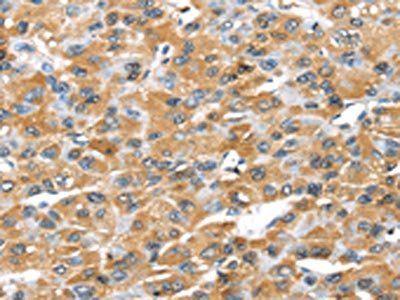 GZMK Antibody
