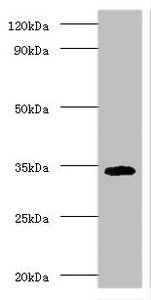 H-2 class II histocompatibility gamma chain antibody