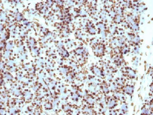 H1 antibody