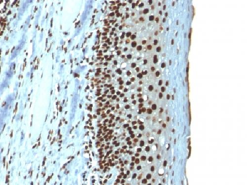 Recombinant Histone H1 (Pan Nuclear Marker) Antibody