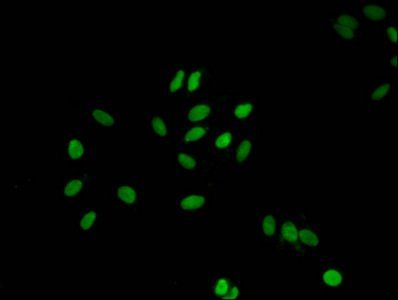 H1F0 (Ab-107) Antibody