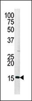 H3 (phospho-Ser28) antibody