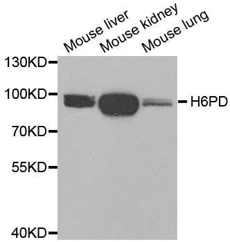 H6PD antibody