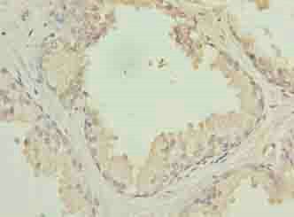 HACD2 Antibody