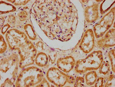HACD3 Antibody