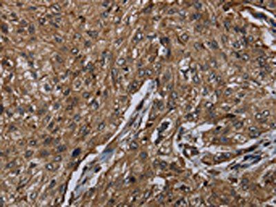 HACL1 Antibody