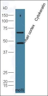 Hair cortex Cytokeratin Rabbit Polyclonal Antibody