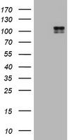 Hamartin (TSC1) antibody