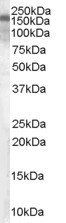 Goat anti-Hamartin / TSC1 (isoform 1) Antibody