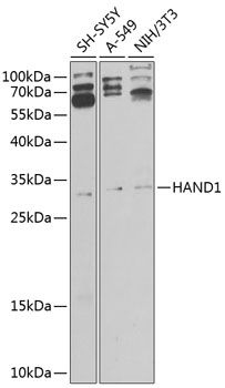HAND1 antibody