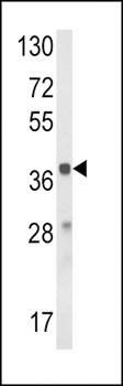 HAO1 antibody